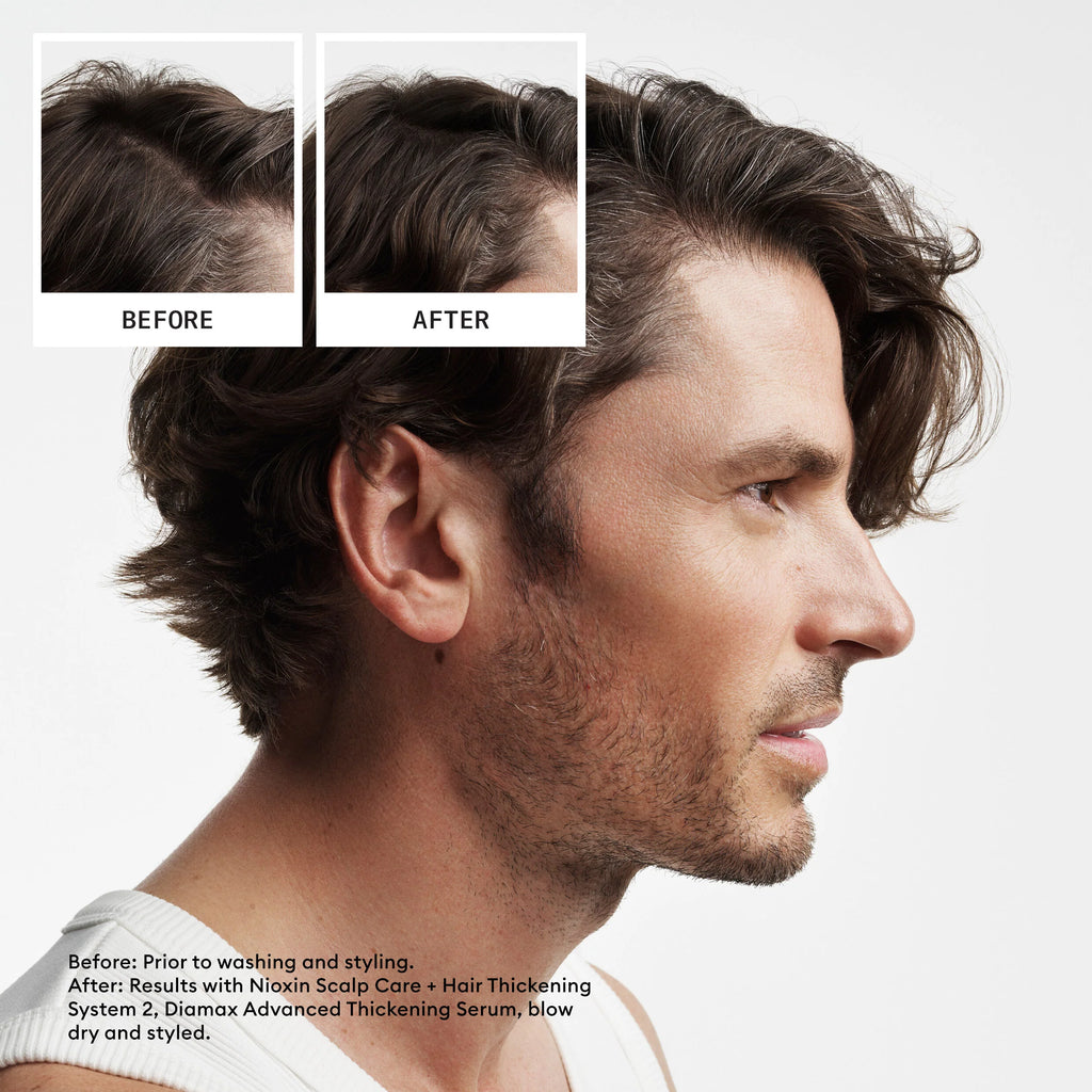 SYSTEM 2 – Complete Scalp & Hair Thickening Kit